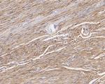 S100B Antibody in Immunohistochemistry (Paraffin) (IHC (P))