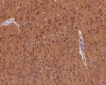 PIEZO1 Antibody in Immunohistochemistry (Paraffin) (IHC (P))