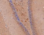 PIEZO1 Antibody in Immunohistochemistry (Paraffin) (IHC (P))