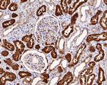 ASS1 Antibody in Immunohistochemistry (Paraffin) (IHC (P))