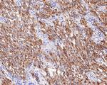 Chromogranin A Antibody in Immunohistochemistry (Paraffin) (IHC (P))