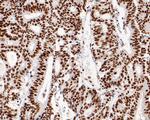 MSH2 Antibody in Immunohistochemistry (Paraffin) (IHC (P))