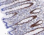 MSH2 Antibody in Immunohistochemistry (Paraffin) (IHC (P))