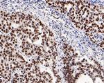 MSH2 Antibody in Immunohistochemistry (Paraffin) (IHC (P))