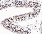 MSH2 Antibody in Immunohistochemistry (Paraffin) (IHC (P))