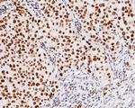 MSH2 Antibody in Immunohistochemistry (Paraffin) (IHC (P))