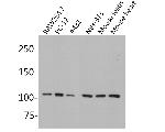 MSH2 Antibody in Western Blot (WB)