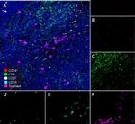 CD57 Antibody in Immunohistochemistry (Paraffin) (IHC (P))