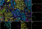 CD57 Antibody in Immunohistochemistry (Paraffin) (IHC (P))