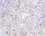 CD68 Antibody in Immunohistochemistry (Paraffin) (IHC (P))