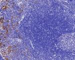 p16INK4a Antibody in Immunohistochemistry (Paraffin) (IHC (P))