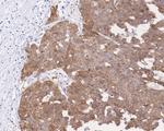 p16INK4a Antibody in Immunohistochemistry (Paraffin) (IHC (P))