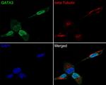 GATA3 Antibody in Immunocytochemistry (ICC/IF)