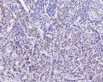 GATA3 Antibody in Immunohistochemistry (Paraffin) (IHC (P))