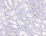 GATA3 Antibody in Immunohistochemistry (Paraffin) (IHC (P))