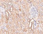 PCBP2 Antibody in Immunohistochemistry (Paraffin) (IHC (P))