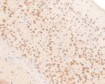 PCBP2 Antibody in Immunohistochemistry (Paraffin) (IHC (P))