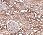 DTYMK Antibody in Immunohistochemistry (Paraffin) (IHC (P))