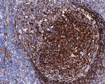 MYO1B Antibody in Immunohistochemistry (Paraffin) (IHC (P))