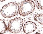 MYO1B Antibody in Immunohistochemistry (Paraffin) (IHC (P))