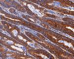 MYO1B Antibody in Immunohistochemistry (Paraffin) (IHC (P))