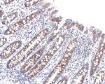 CECR5 Antibody in Immunohistochemistry (Paraffin) (IHC (P))