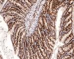 PIN4 Antibody in Immunohistochemistry (Paraffin) (IHC (P))