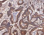 PEX11B Antibody in Immunohistochemistry (Paraffin) (IHC (P))