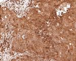 PEX11B Antibody in Immunohistochemistry (Paraffin) (IHC (P))