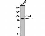 Villin Antibody in Western Blot (WB)