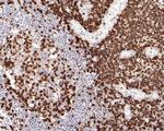 CD5 Antibody in Immunohistochemistry (Paraffin) (IHC (P))