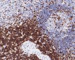 CD5 Antibody in Immunohistochemistry (Paraffin) (IHC (P))