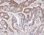 c-Myc Antibody in Immunohistochemistry (Paraffin) (IHC (P))