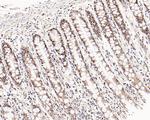 c-Myc Antibody in Immunohistochemistry (Paraffin) (IHC (P))