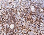 Hemoglobin alpha Antibody in Immunohistochemistry (Paraffin) (IHC (P))