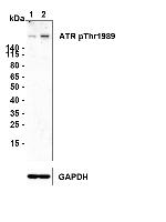 Phospho-ATR (Thr1989) Antibody in Western Blot (WB)