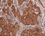 eIF4E Antibody in Immunohistochemistry (Paraffin) (IHC (P))