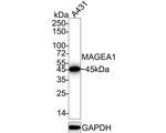 MAGE1 Antibody in Immunohistochemistry (Paraffin) (IHC (P))