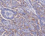 SLC34A2 Antibody in Immunohistochemistry (Paraffin) (IHC (P))