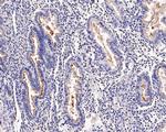 SLC34A2 Antibody in Immunohistochemistry (Paraffin) (IHC (P))