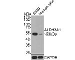 ALDH3A1 Antibody in Western Blot (WB)