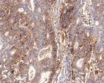 ENT1 Antibody in Immunohistochemistry (Paraffin) (IHC (P))