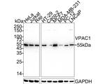 VIPR1 Antibody in Western Blot (WB)