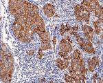 ErbB2 (HER-2) Antibody in Immunohistochemistry (Paraffin) (IHC (P))