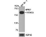 ErbB2 (HER-2) Antibody in Western Blot (WB)