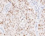 p53 Antibody in Immunohistochemistry (Paraffin) (IHC (P))