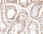 UBE1L Antibody in Immunohistochemistry (Paraffin) (IHC (P))