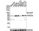 SMAD4 Antibody in Western Blot (WB)