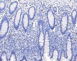 SOX10 Antibody in Immunohistochemistry (Paraffin) (IHC (P))