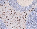 SOX10 Antibody in Immunohistochemistry (Paraffin) (IHC (P))